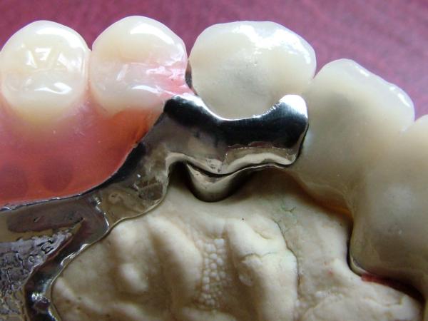 fogászat dentistry XI.kerület DaviDent - Zsila Dávid rendelője - fog teeth