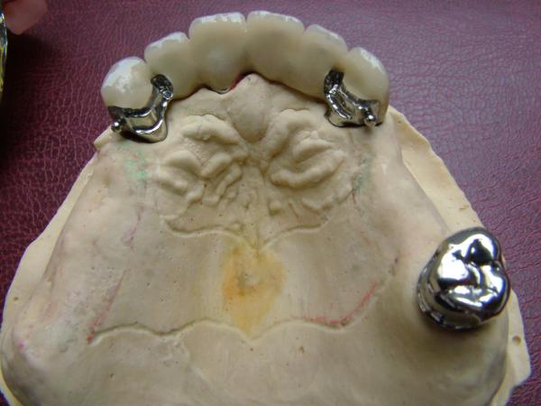 fogászat dentistry XI.kerület DaviDent - Zsila Dávid rendelője - fog teeth